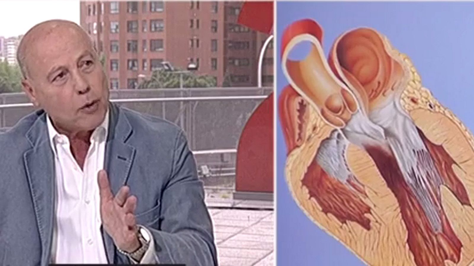 El doctor Corbalán: "No es prudente competir como profesional después de un infarto" - Informativo 24h | Ver