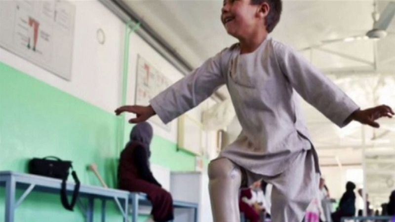 Ahmad, el niño afgano que baila para celebrar su nueva prótesis