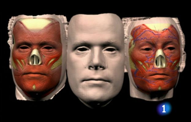 Ciencia y tecnología en Rtve.es - Trasplantes de cara