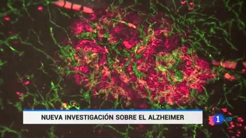 Descubren una nueva diana terapéutica para el tratamiento del alzhéimer en ratones