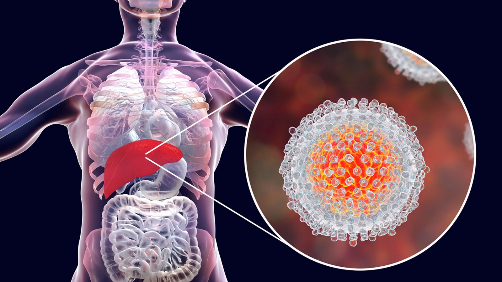 Telediario 1: En el Día Mundial de la Hepatitis las asociaciones de afectados recuerdan la importancia del diagnóstico precoz | RTVE Play