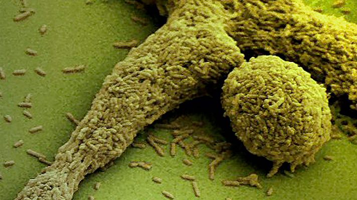 La noche temática - La conexión intestino-cerebro - Avance