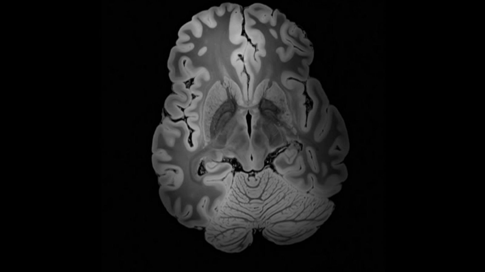 Lab24 - Exclusivamente Alzheimer y Climatizar en el Ártico - ver ahora