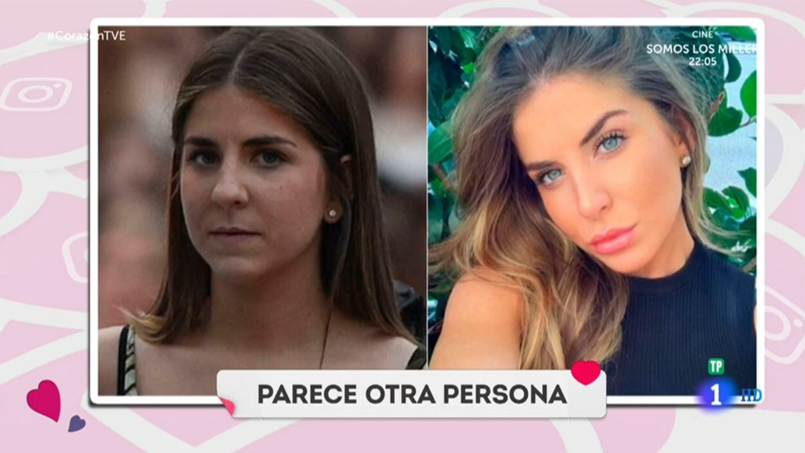 Corazón - Las operaciones estéticas de Mar Torres, la exnovia de Froilán - D Corazón | Ver