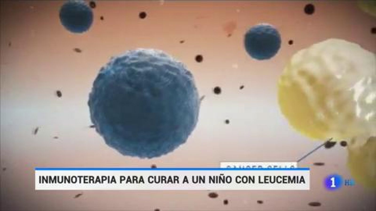 Consiguen con inmunoterapia curar la leucemia de un niño de once años en el Hospital de la Paz