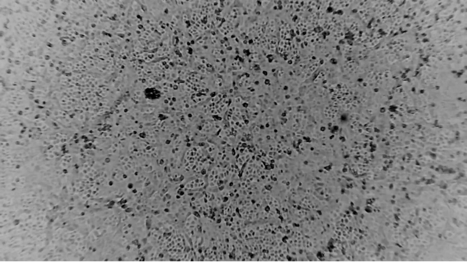 En España se trabaja en una vacuna para el coronavirus chino