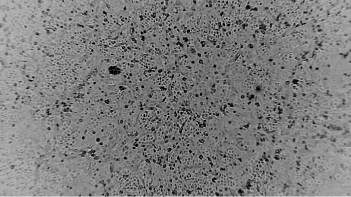 Especial Coronavirus - En España se trabaja en una vacuna para el coronavirus chino
