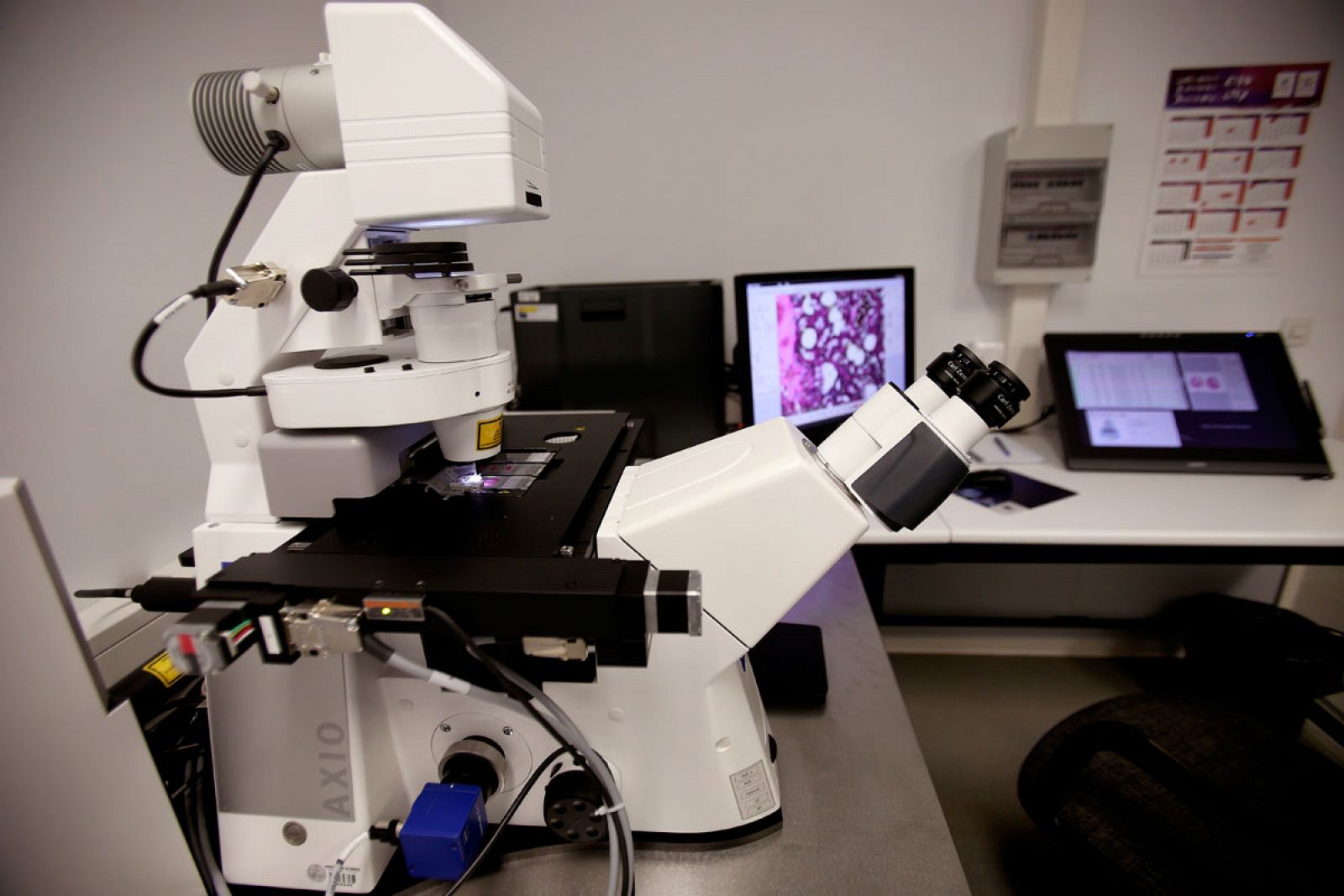 Ciencia: un estudio genómico sin precedentes podría cambiar el modo de combatir el cáncer - RTVE.es