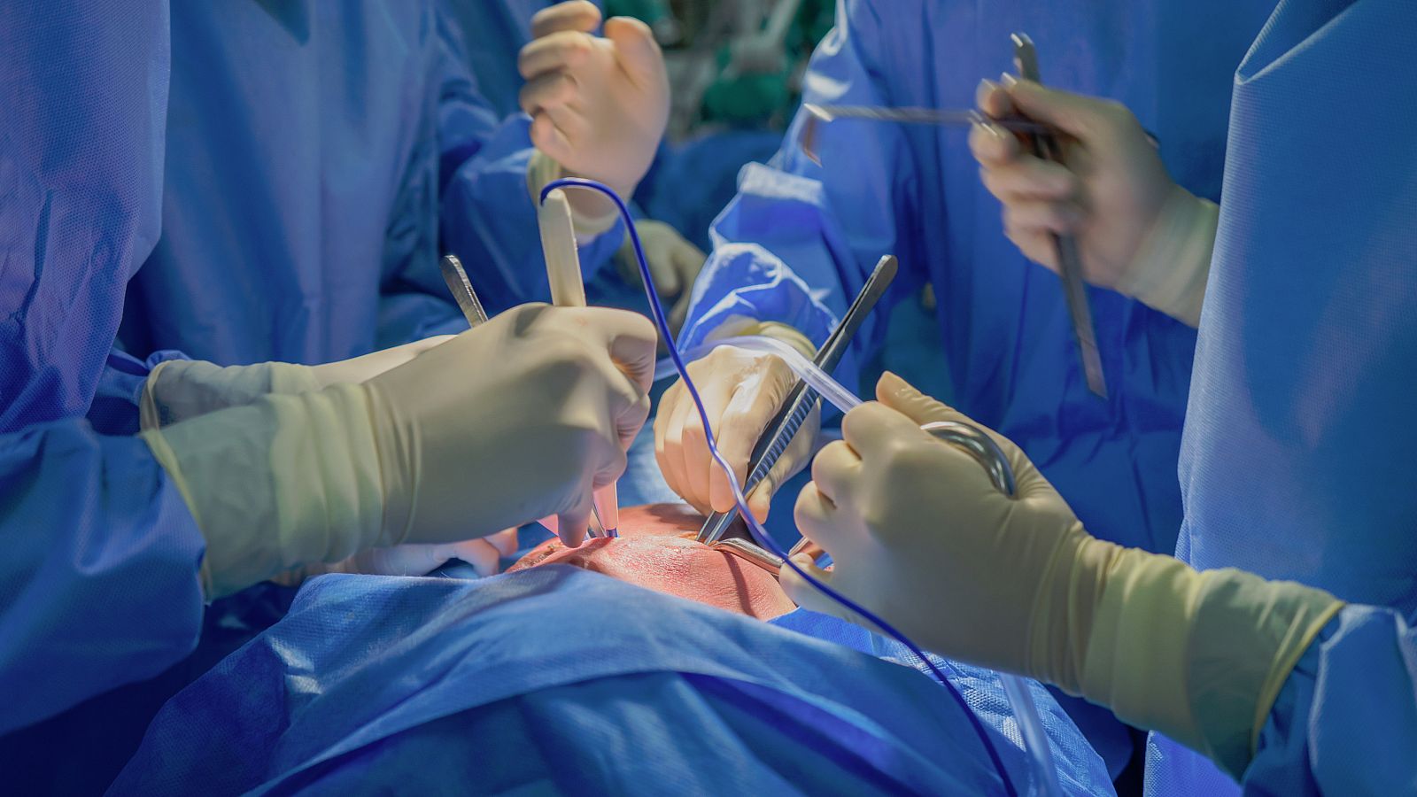 Telediario 1: Realizan en España el primer trasplante cardíaco de donante en parada cardiorrespiratoria | RTVE Play