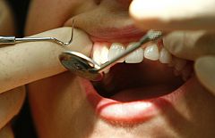 Reporteros del telediario - El intrusismo es uno de los problemas más graves que tiene el colectivo de dentistas en España
