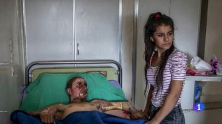 Telediario 1 - Un desastre aéreo y protestas sociales, nominados al World Press Photo 2020