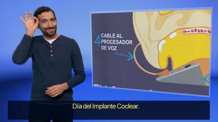 En lengua de signos - En lengua de signos - 01/03/20