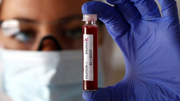 Coronavirus | Sanidad hará más test porque solo en Madrid hay más de 20.000 casos sospechosos