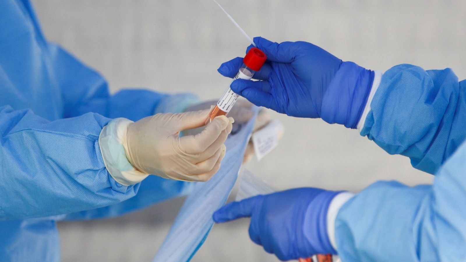 Coronavirus: Sanidad compró 58.000 test defectuosos en China | Ver