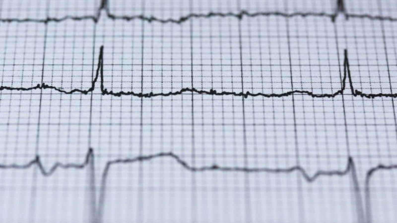 Los cardiólogos alertan de que pacientes con infartos ¿no acuden a urgencias por miedo a contagiarse¿
