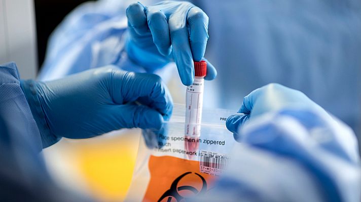 Telediario 1 - ¿Se puede ver el coronavirus en una superficie?