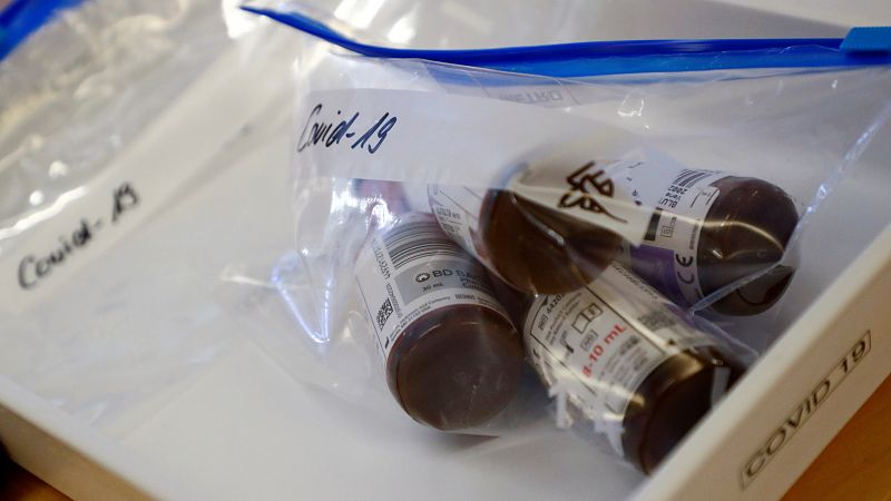 Una de las técnicas que se están probando para luchar contra el coronavirus es la trasfusión de plasma sanguíneo de personas que han superado la enfermedad, a pacientes infectados. Lo está haciendo en Andalucía la Fundación Progreso y Salud en catorc