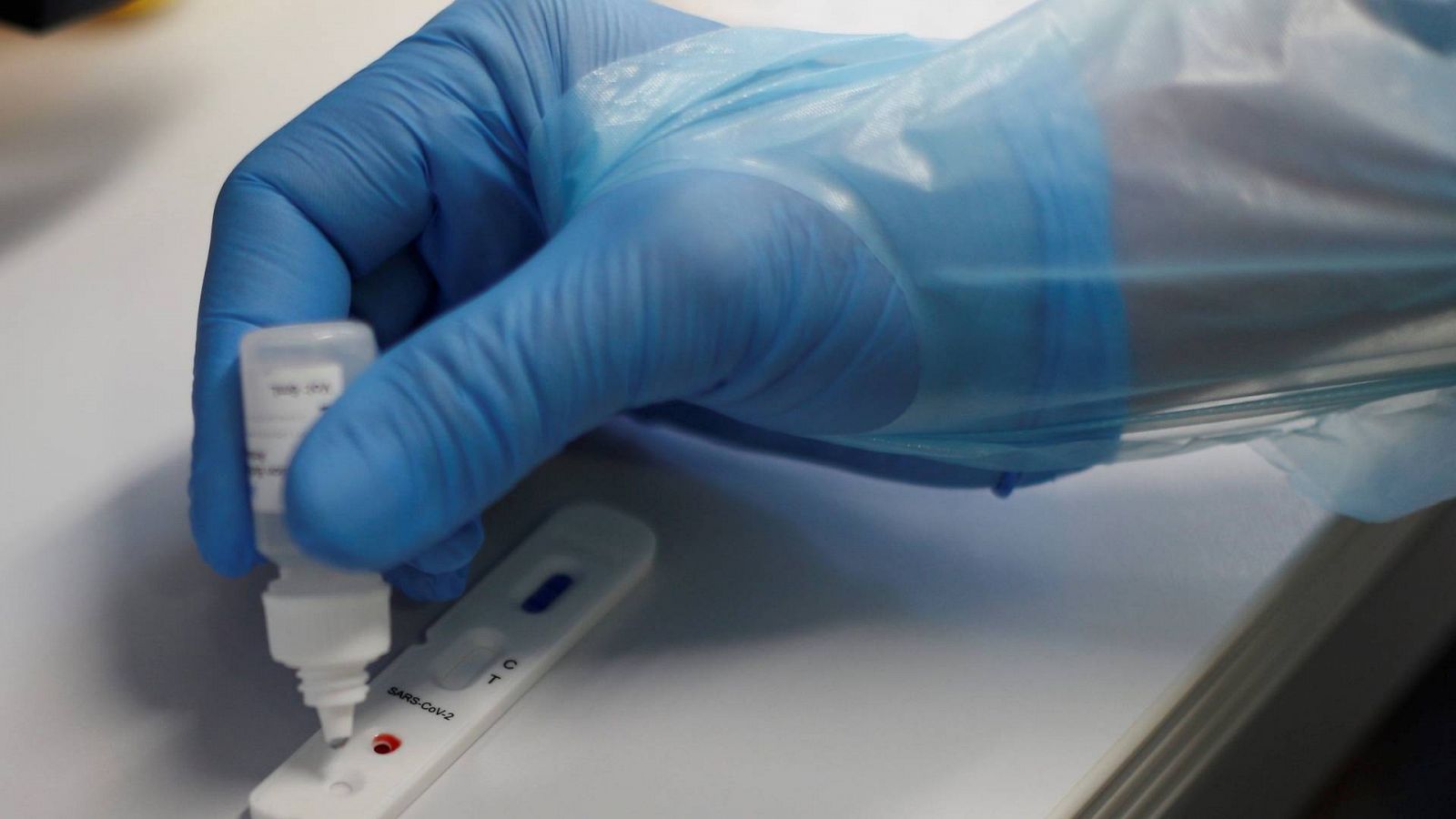 Los clubes tienen test del cororonavirus, entre la polémica | Ver