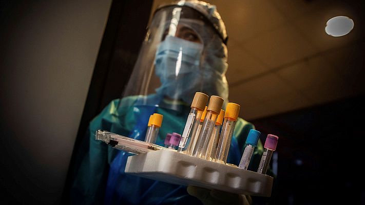 Especial Coronavirus - Castilla y León ha realizado 120.000 test de los 450.000 que ha comprado la Junta