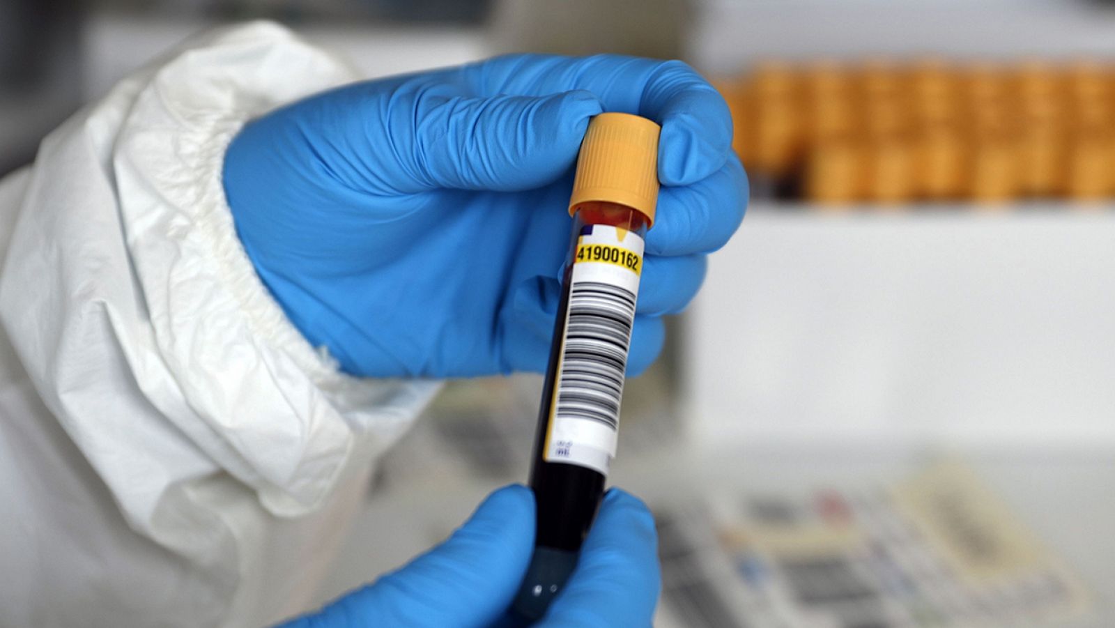 Coronavirus | Sanidad inicia los test de detección en casos sospechosos