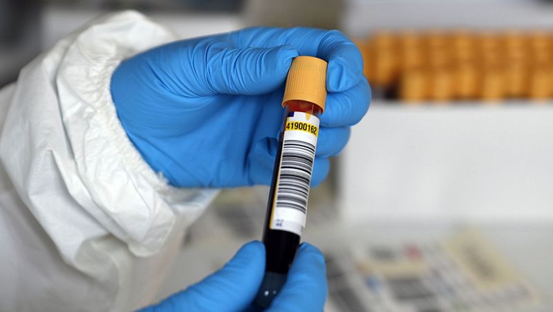 Coronavirus | Sanidad inicia los test de detección en casos sospechosos - Especiales informativos | Ver