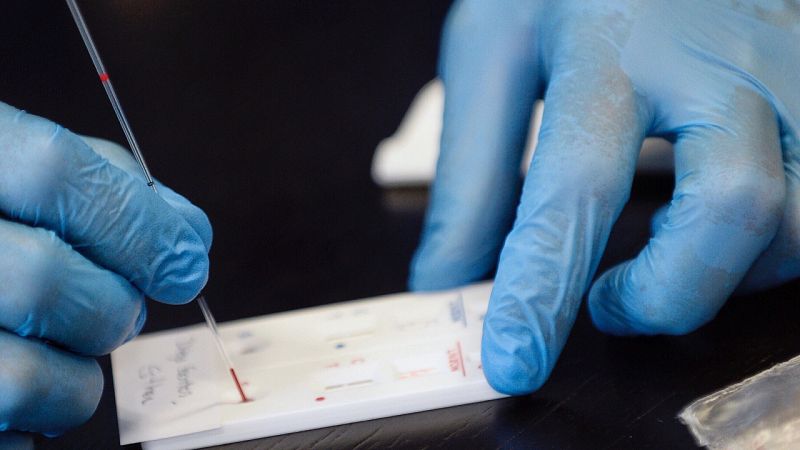 Sanidad estudiará si la transmisión del virus es menor aunque se hayan hecho mas PCR