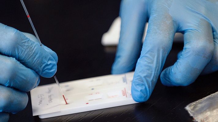 Clínicas y laboratorios privados ofrecen tests rápidos y serológicos desde 40 euros
