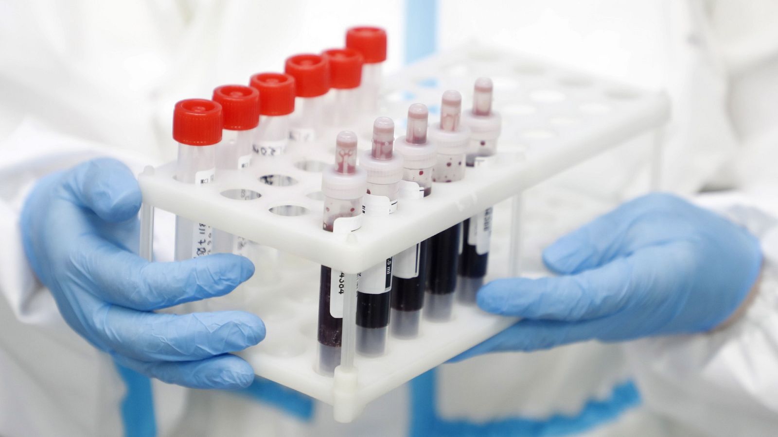 Coronavirus | El Hospital Gregorio Marañón investiga el origen de un brote de Covid-19 en el servicio de neumología