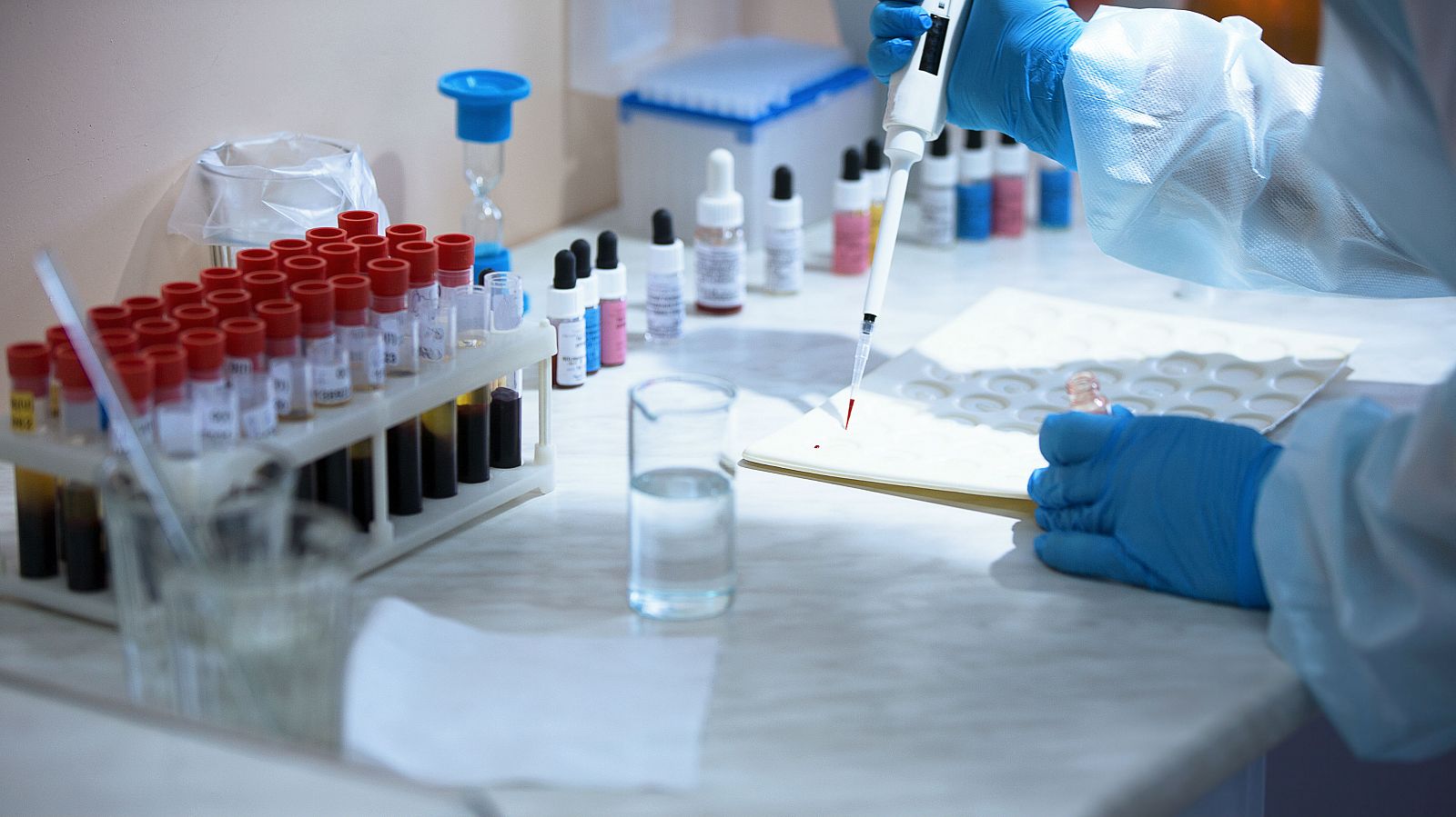Las personas con grupo sanguíneo A tienen más riesgo de desarrollar patologías graves por coronavirus, según un estudio del Hospital Vall D'Hebrón - RTVE.es