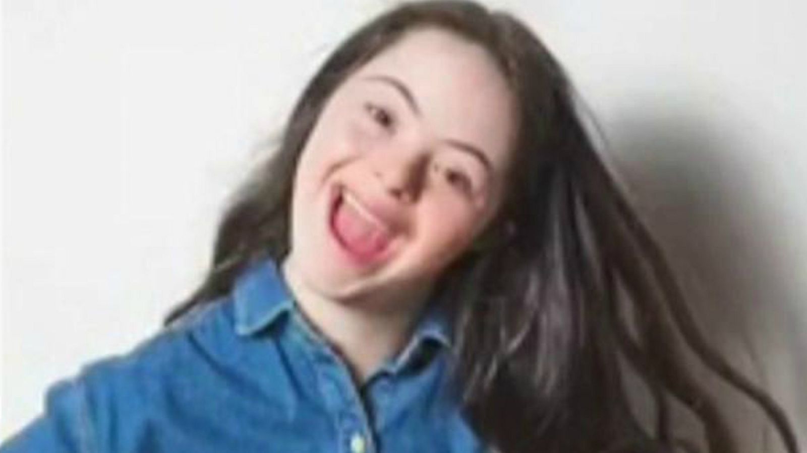 La joven británica Ellie Goldstein, primera modelo con Síndrome de Down en ser imagen de una campaña de Gucci | Ver