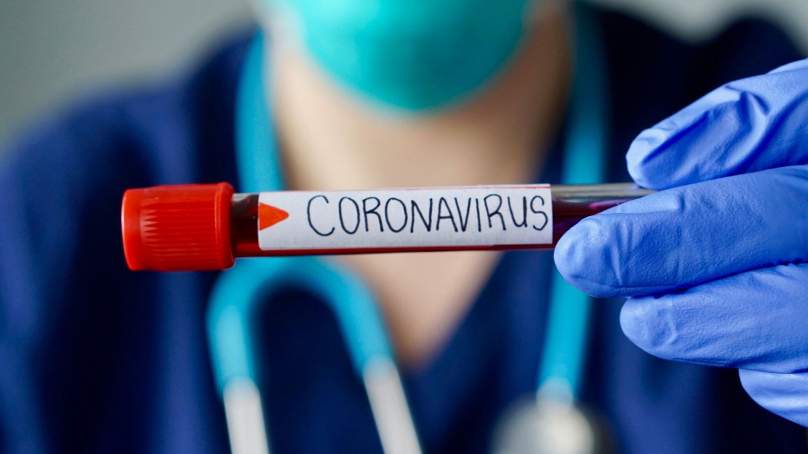 El plasma hiperinmune podría reducir el ingreso en UCI o fallecimiento por coronavirus