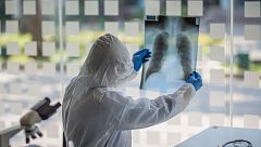 Algunos pacientes continúan sufriendo secuelas de la COVID-19, meses después del contagio