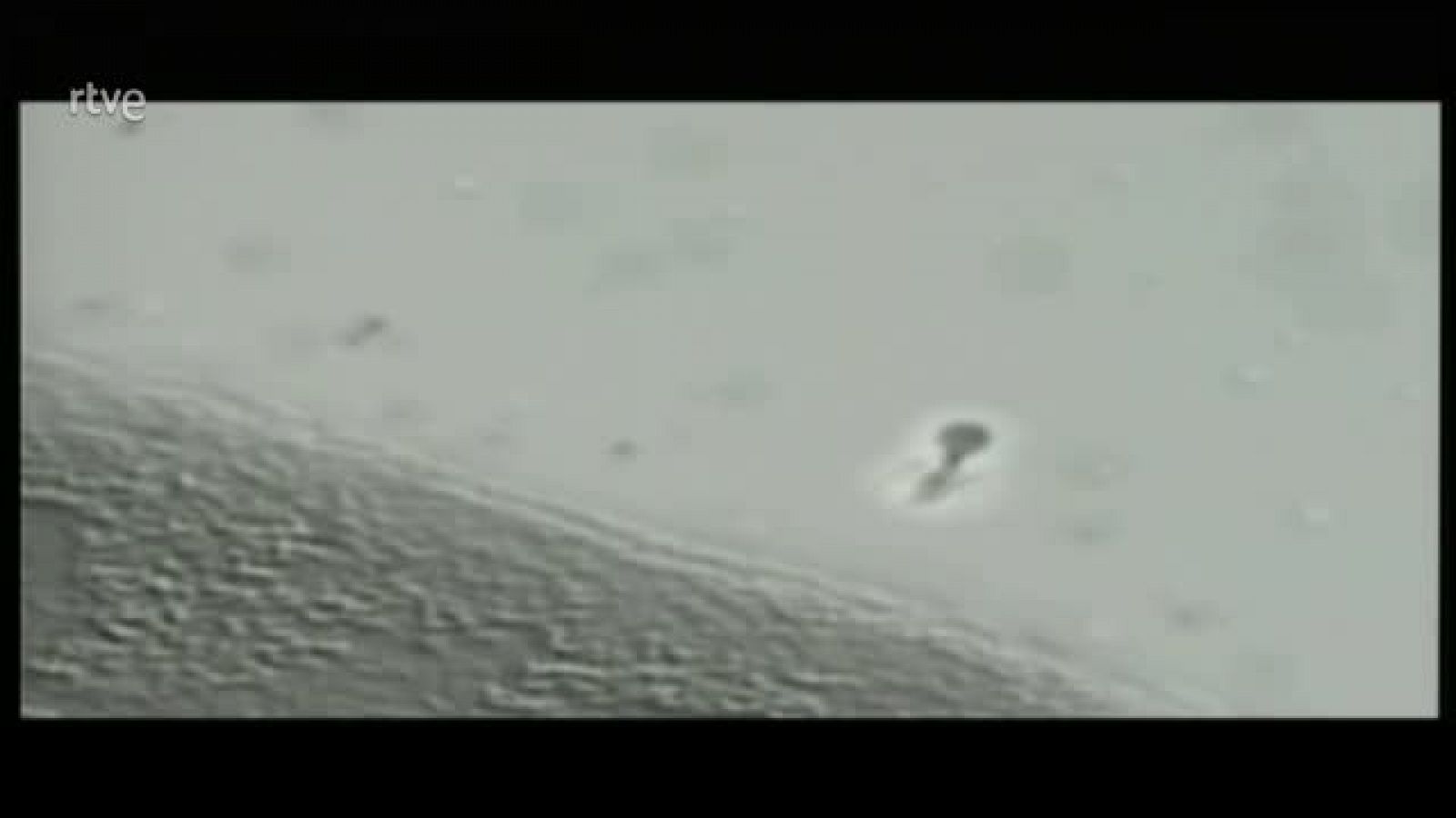 Crónicas Virus: Amenaza permanente - Crónicas | Ver