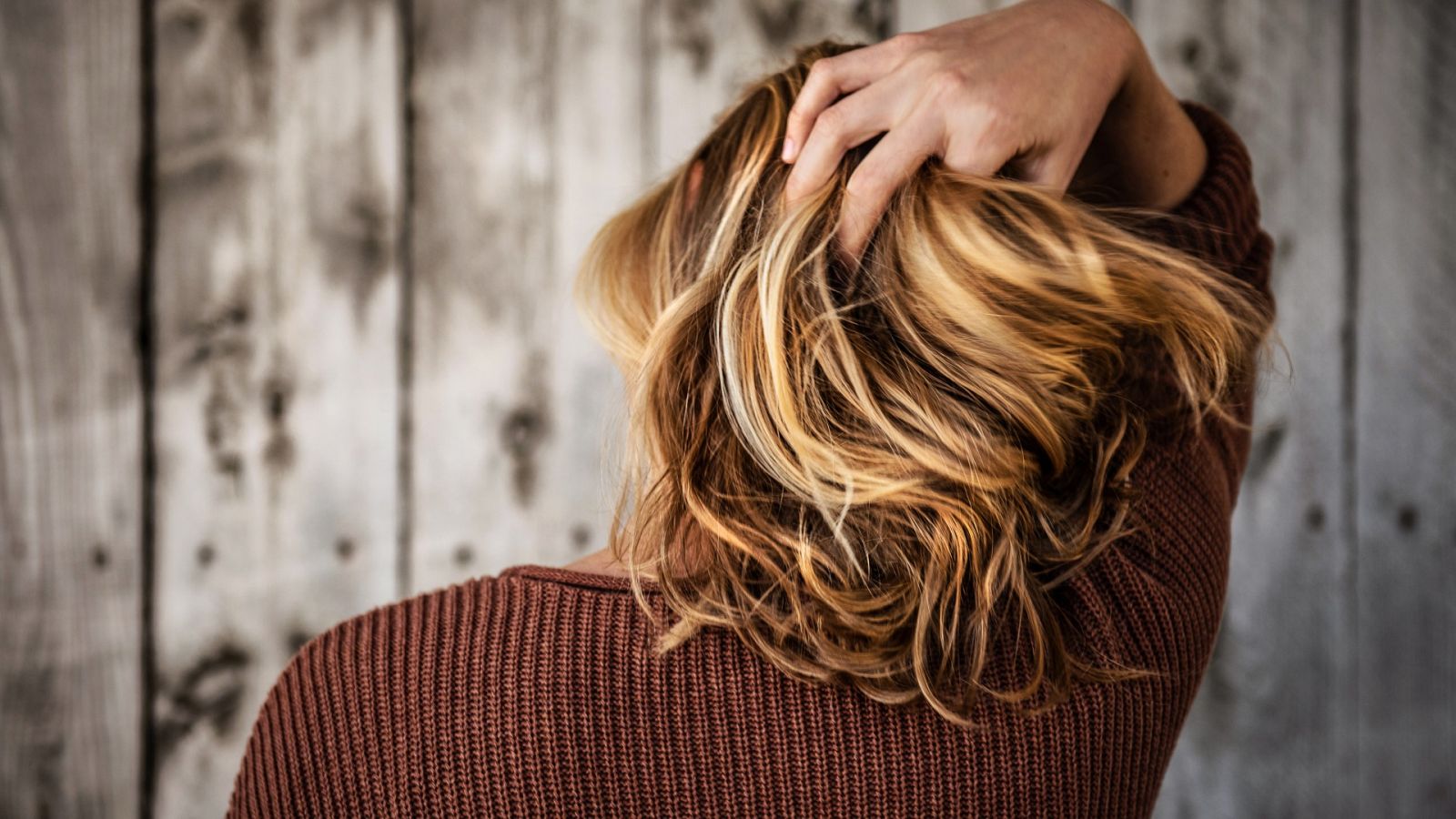 Alopecia y covid