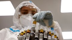 La inmunidad frente al coronavirus podría durar años