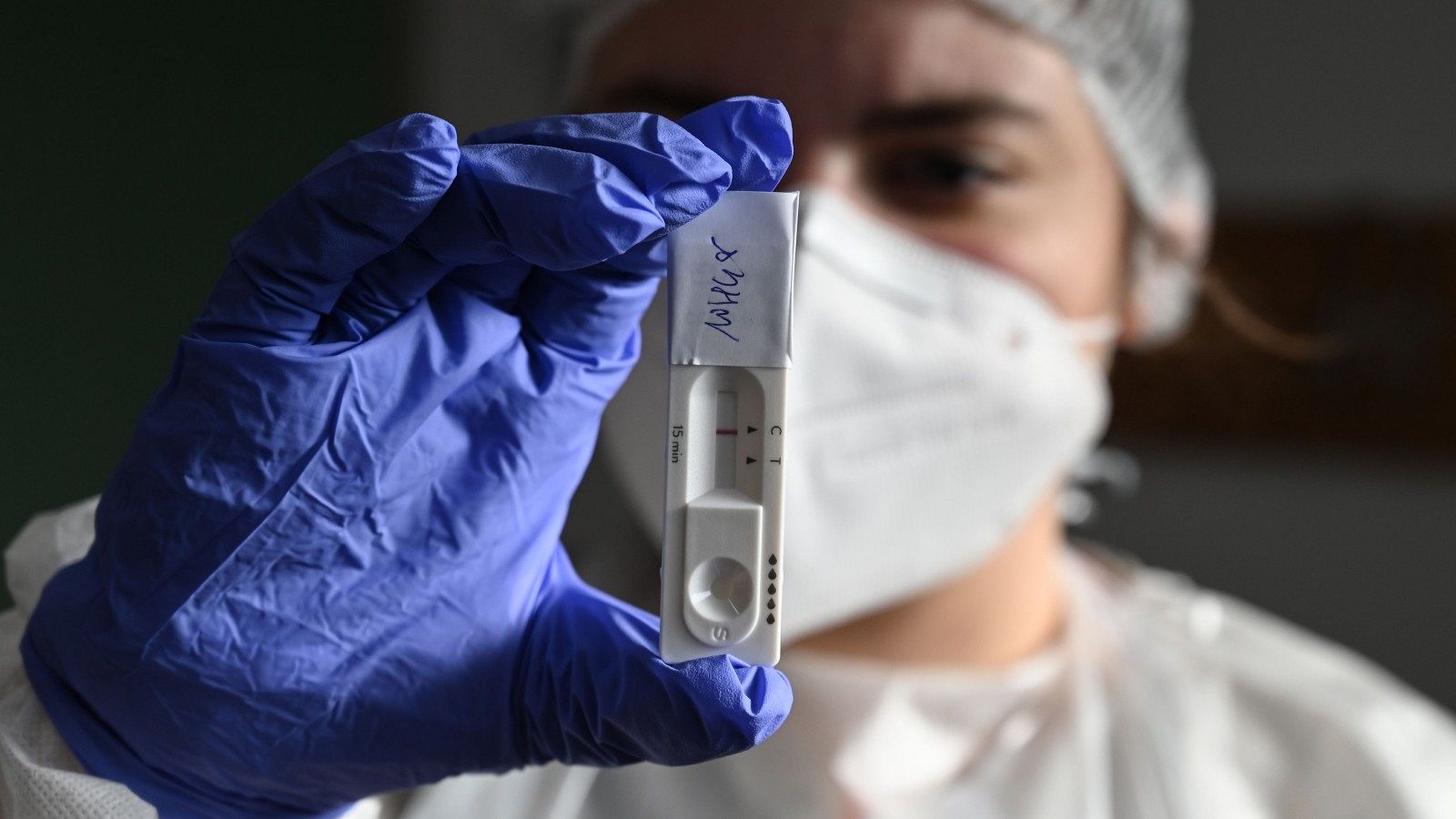 Coronavirus | Simón: los test de antígenos pueden ser útiles