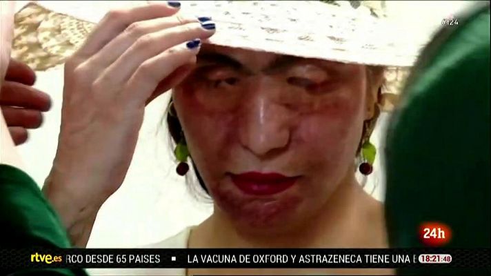 Cada año, millones de mujeres y niñas sufren violencia machista en el mundo