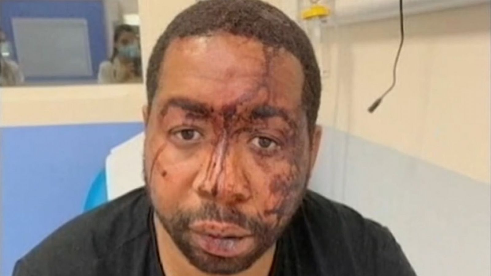 Conmoción en Francia por la agresión policial a un hombre negro