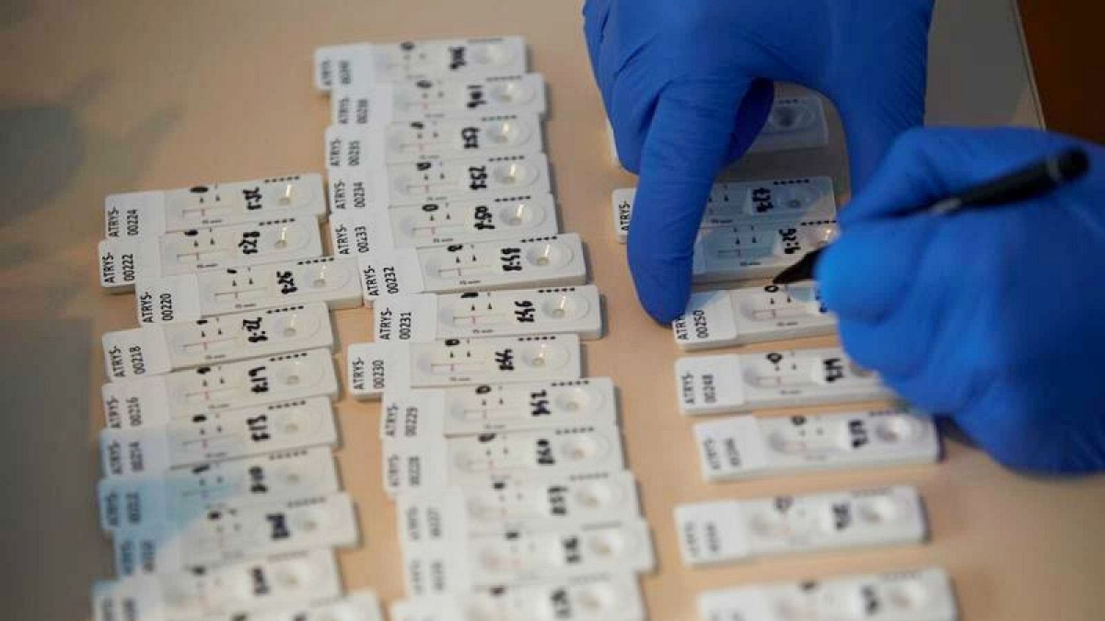 Sanidad desaconseja los test de autodiagnóstico de venta en farmacias