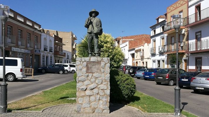 Informativo 24h - Un viaje a Turquía para someterse a implantes capilares puede ser el origen de un brote en Calamonte