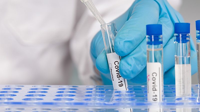 Nuevo test de anticuerpos con una fiabilidad de casi el 100% - La hora de La 1 | Ver