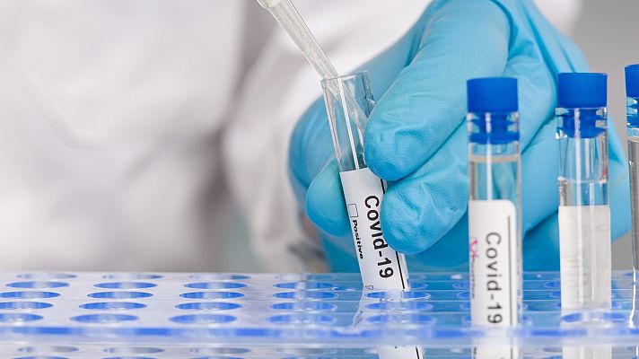 La hora de La 1 - Nuevo test de anticuerpos con una fiabilidad de casi el 100%