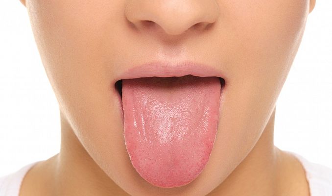 Alteraciones en la lengua, otro síntoma de la COVID-19