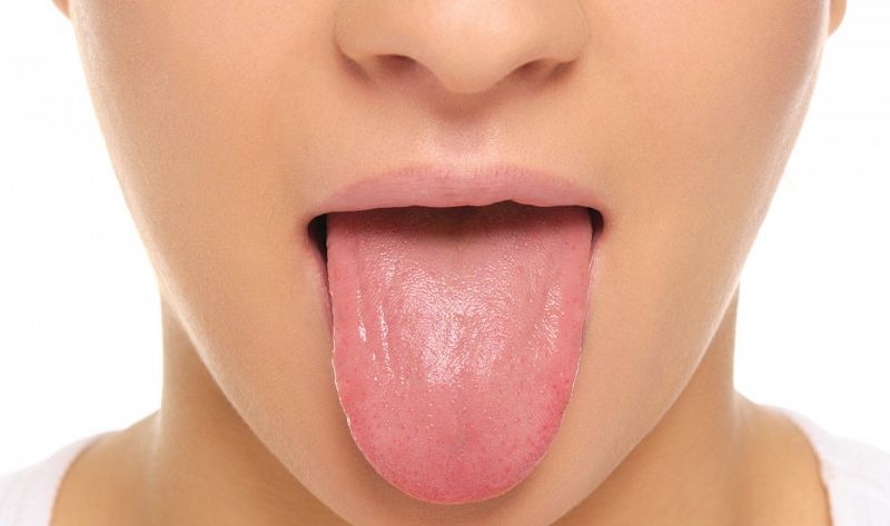 Las alteraciones en la lengua son otro de los síntomas del COVID-19, según un estudio