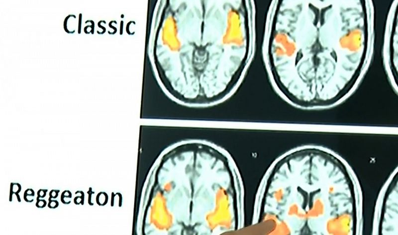 El reguetón activa el cerebro "muchísimo más que los demás estilos" musicales