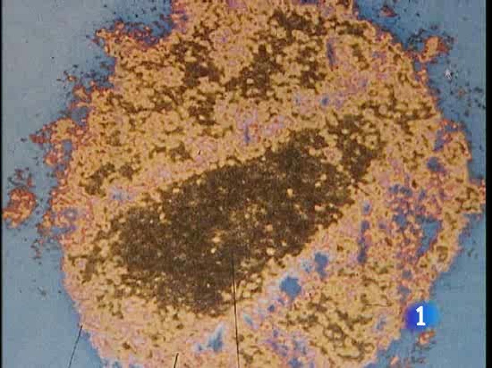  Los investigadores del sida han otro paso importante y han descubierto unos anticuerpos capaces de entrar en el virus de esa enfermedad. Así se acercan un poco más a una todavía lejana vacuna eficaz.