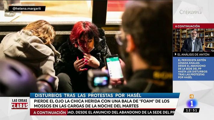 Las cosas claras - Los Mossos investigarán si un proyectil de foam causó la pérdida del ojo de una manifestante