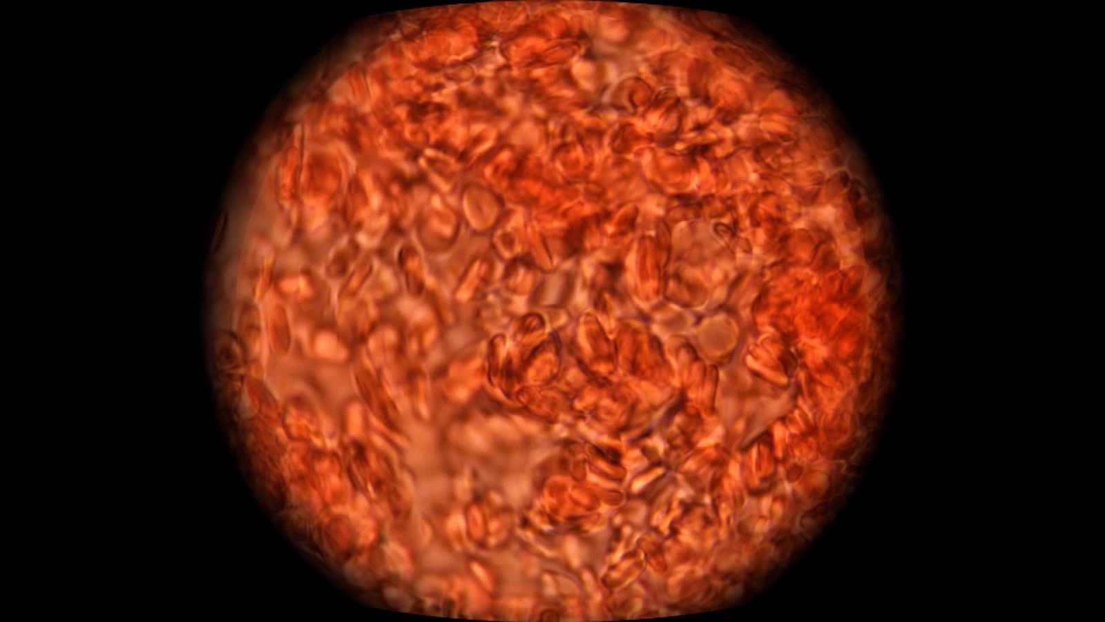 ¡Qué animal! - ¿De qué color es la sangre?