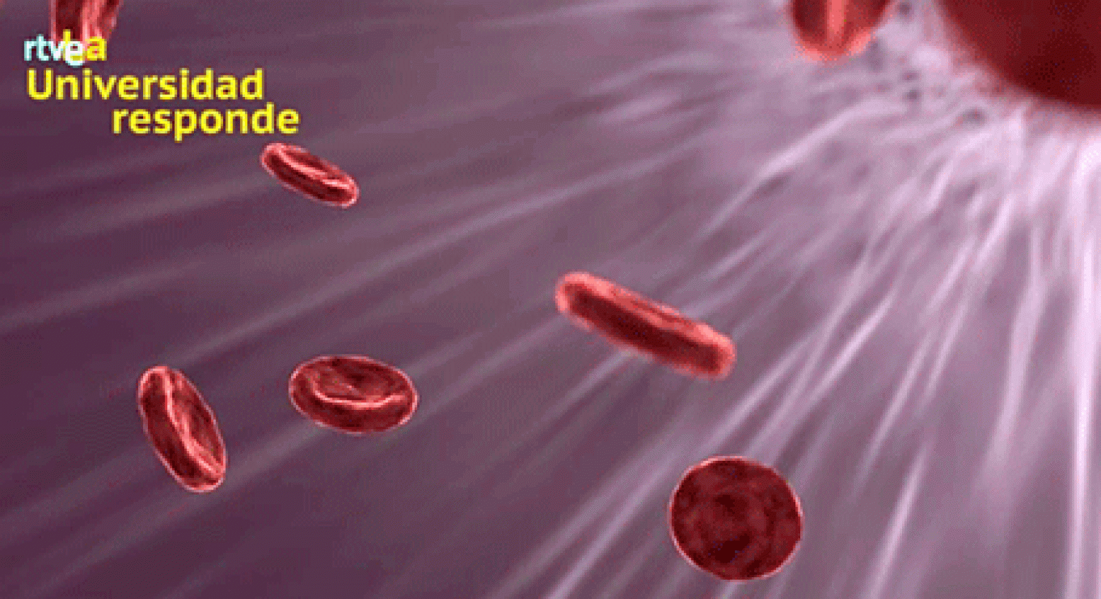 La aventura del saber actuar ante un ictus Miguel Hernández Universidad Responde #AventuraSaberUResponde