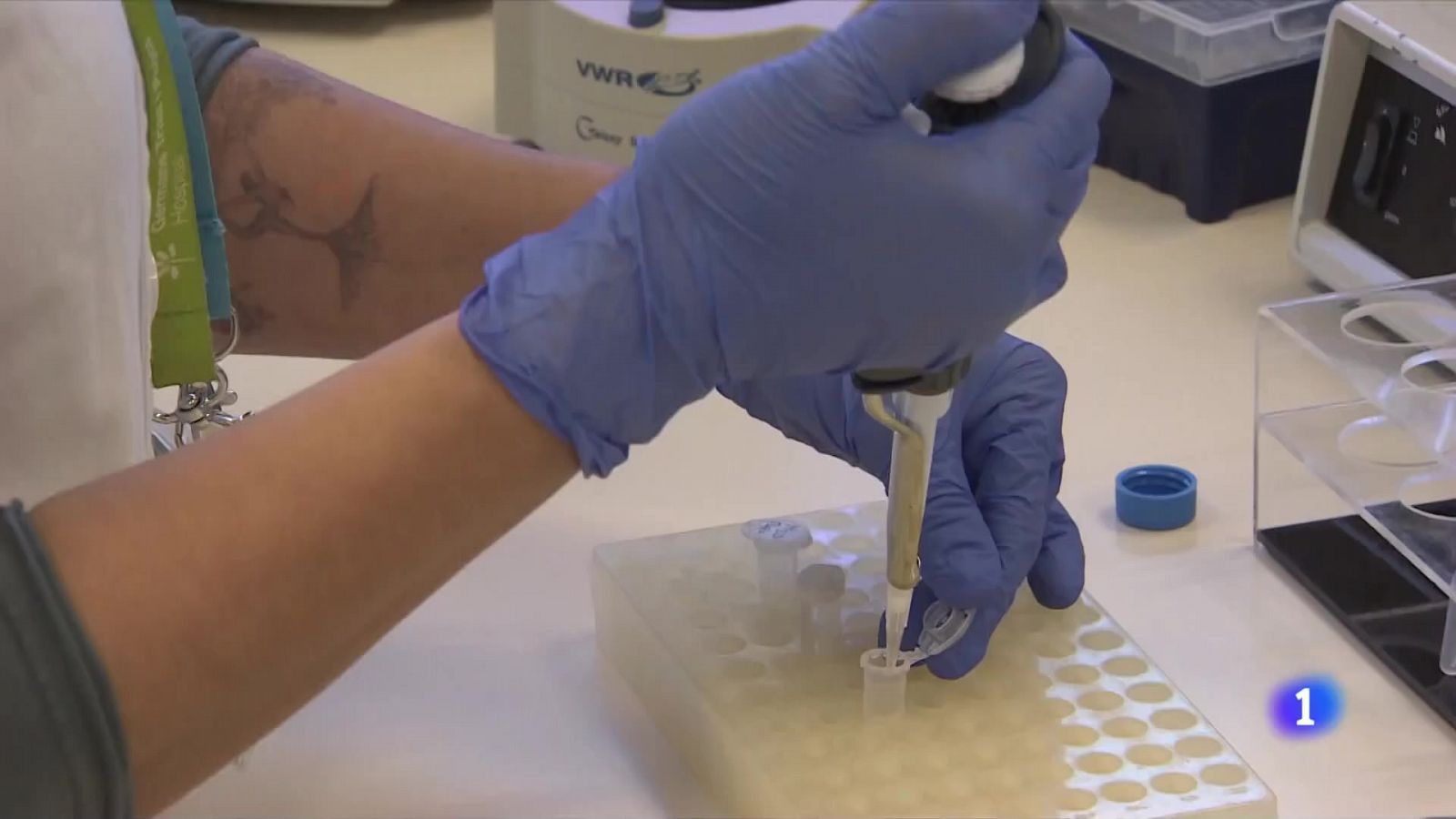 Una vacuna contra el VIH millora el seu control